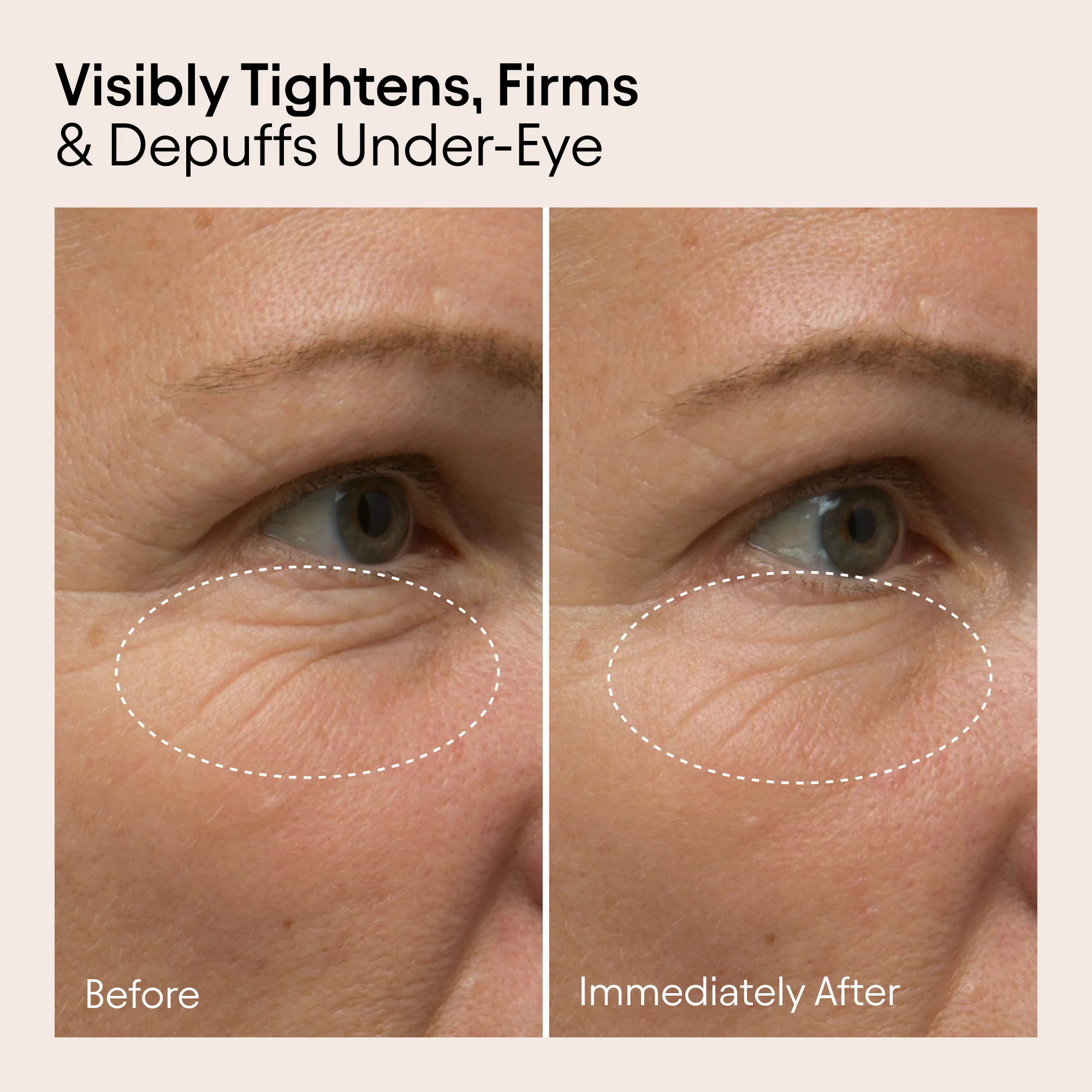 Line-Filling Eye Balm 3 Line-Filling Eye Balm