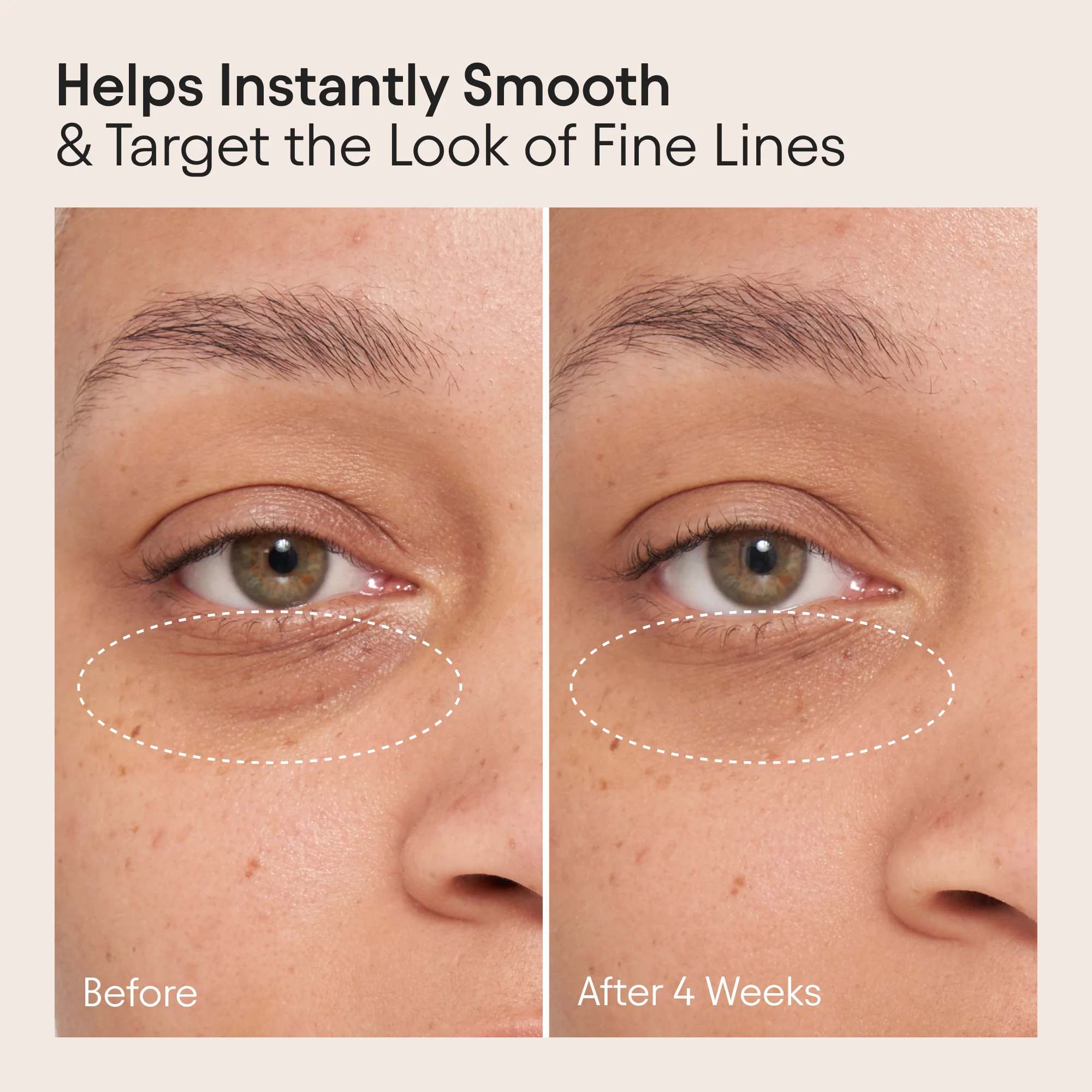 Line-Filling Eye Balm 4 Line-Filling Eye Balm