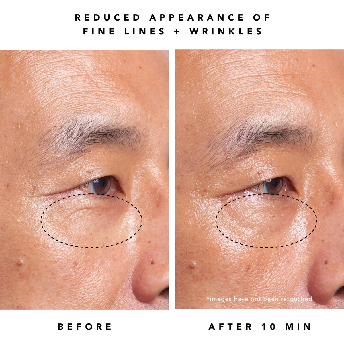Moon Dew 1% Bakuchiol + Peptides Retinol Alternative Eye Cream 5 Moon Dew 1% Bakuchiol + Peptides Retinol Alternative Eye Cream