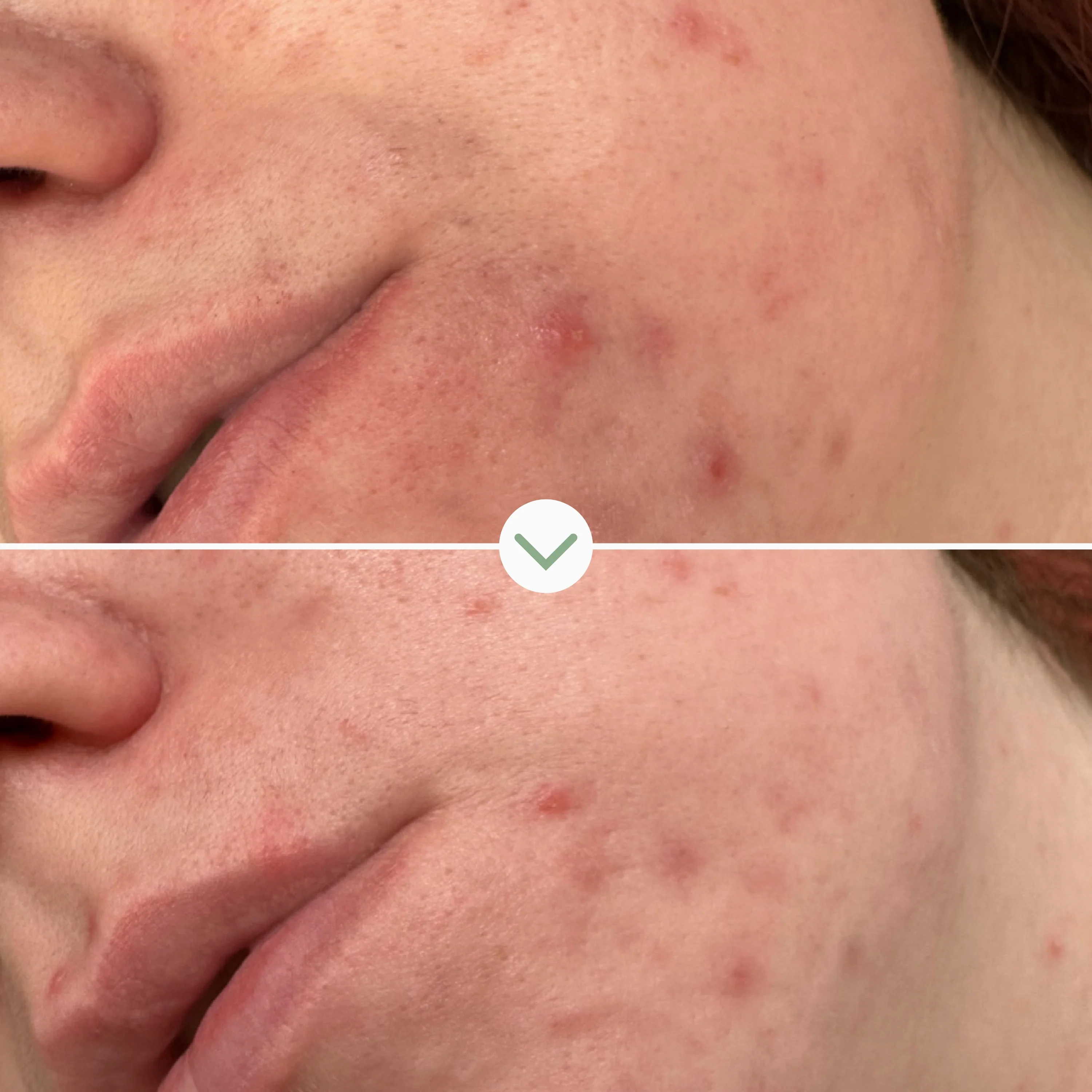 Phaze Rebalance Cleanser 5 Phaze Rebalance Cleanser