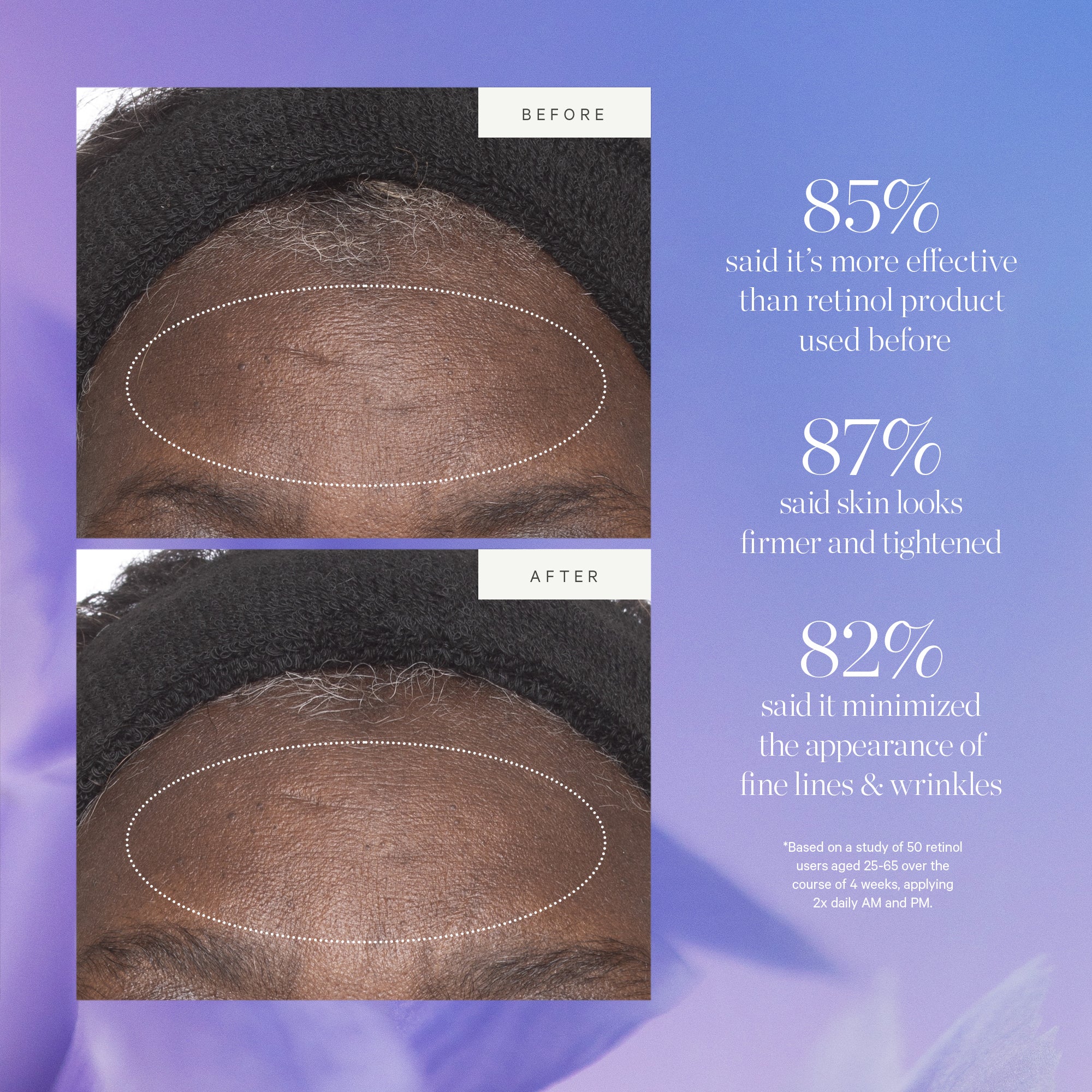 Plant Stem Cell Retinol Alternative Moisturizer 5 Plant Stem Cell Retinol Alternative Moisturizer