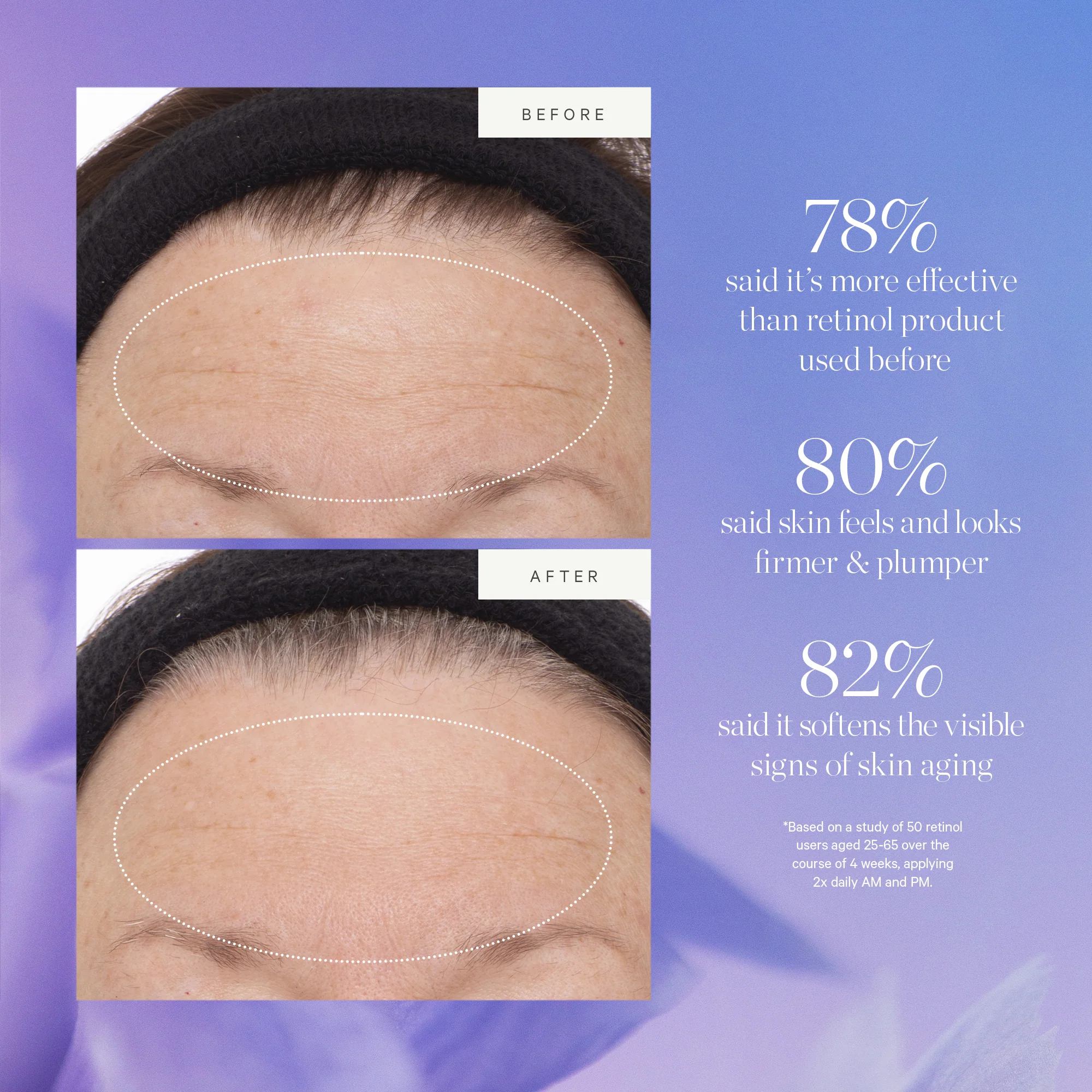 Plant Stem Cell Retinol Alternative Serum 5 Plant Stem Cell Retinol Alternative Serum