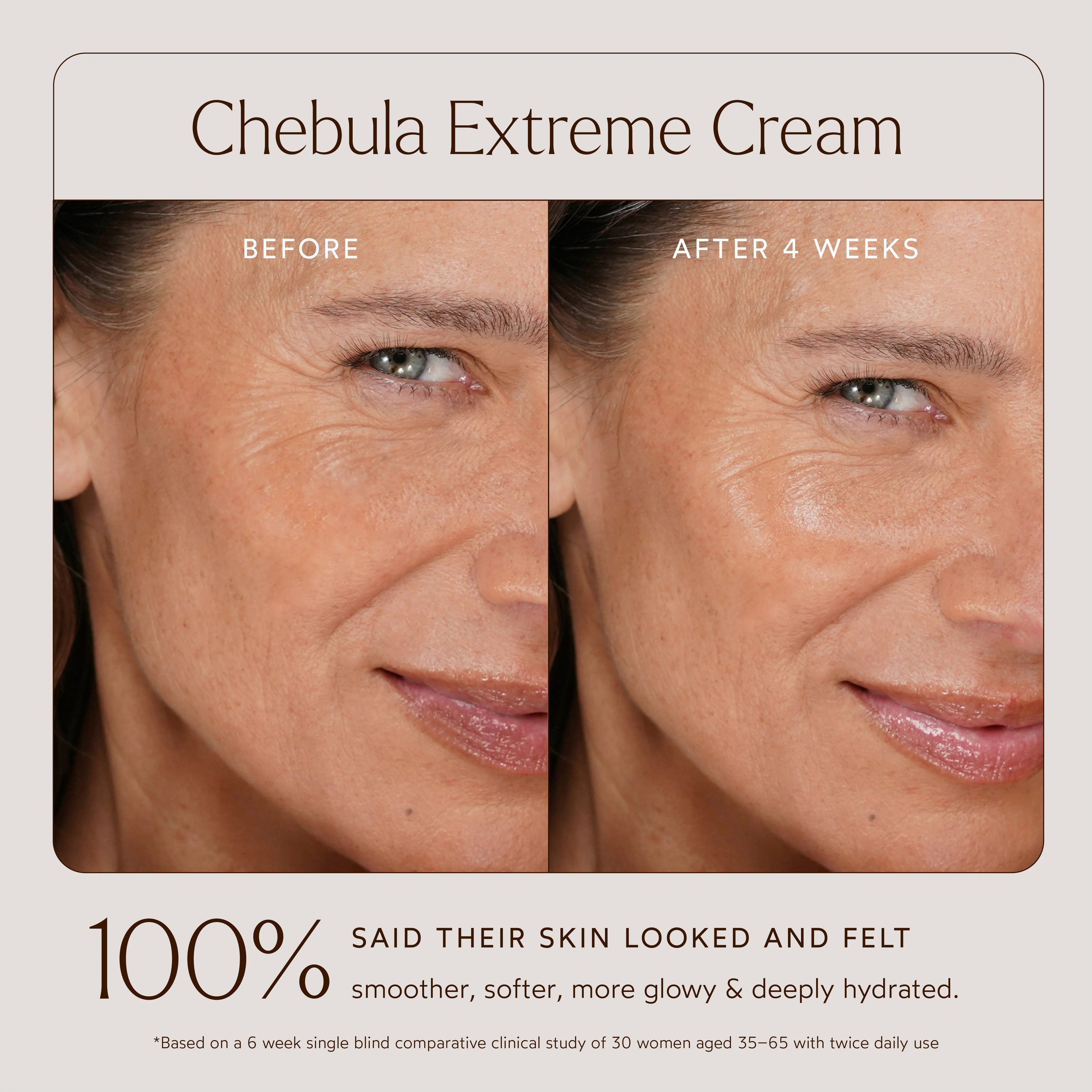 Renew Chebula Extreme Cream 3 Renew Chebula Extreme Cream