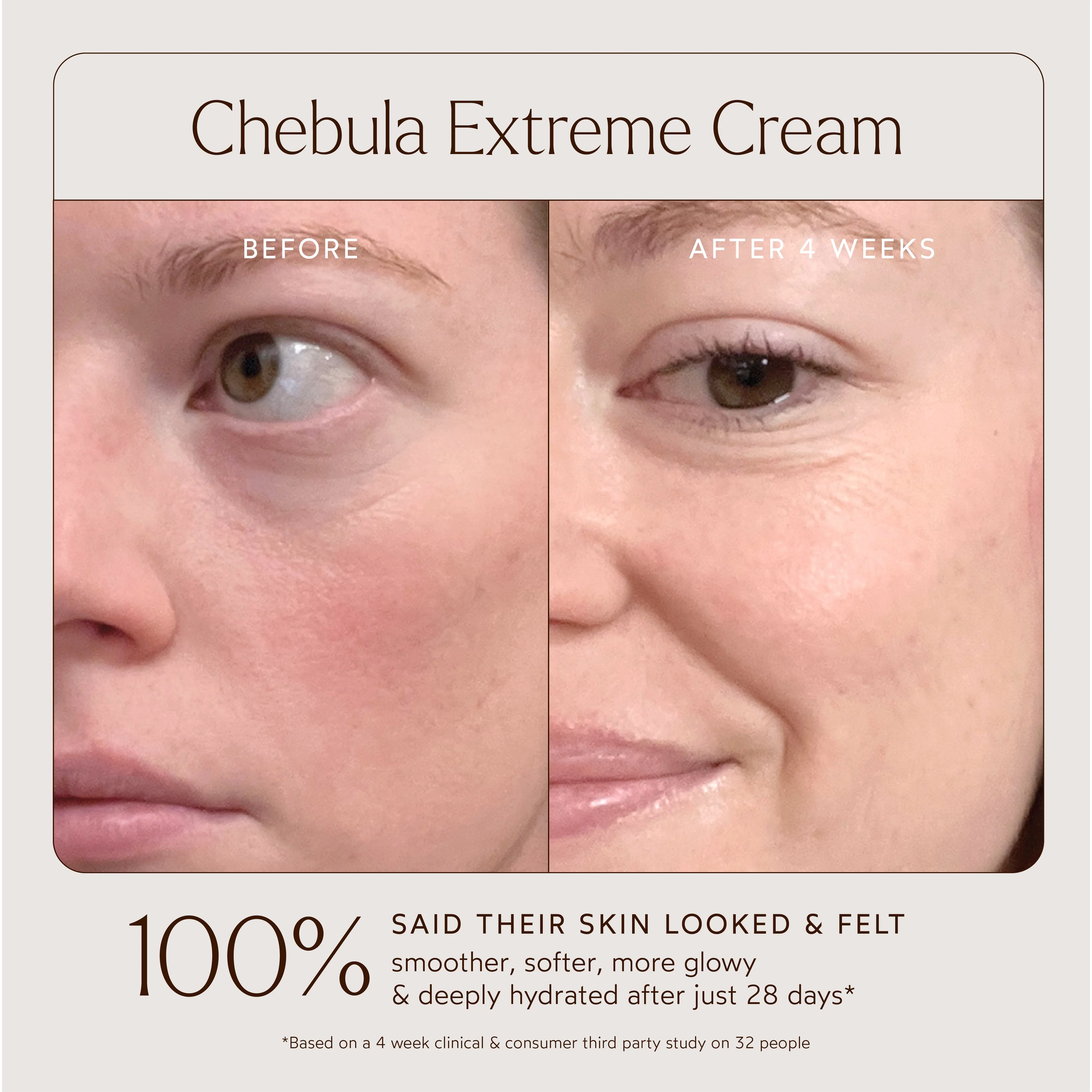Renew Chebula Extreme Cream 4 Renew Chebula Extreme Cream