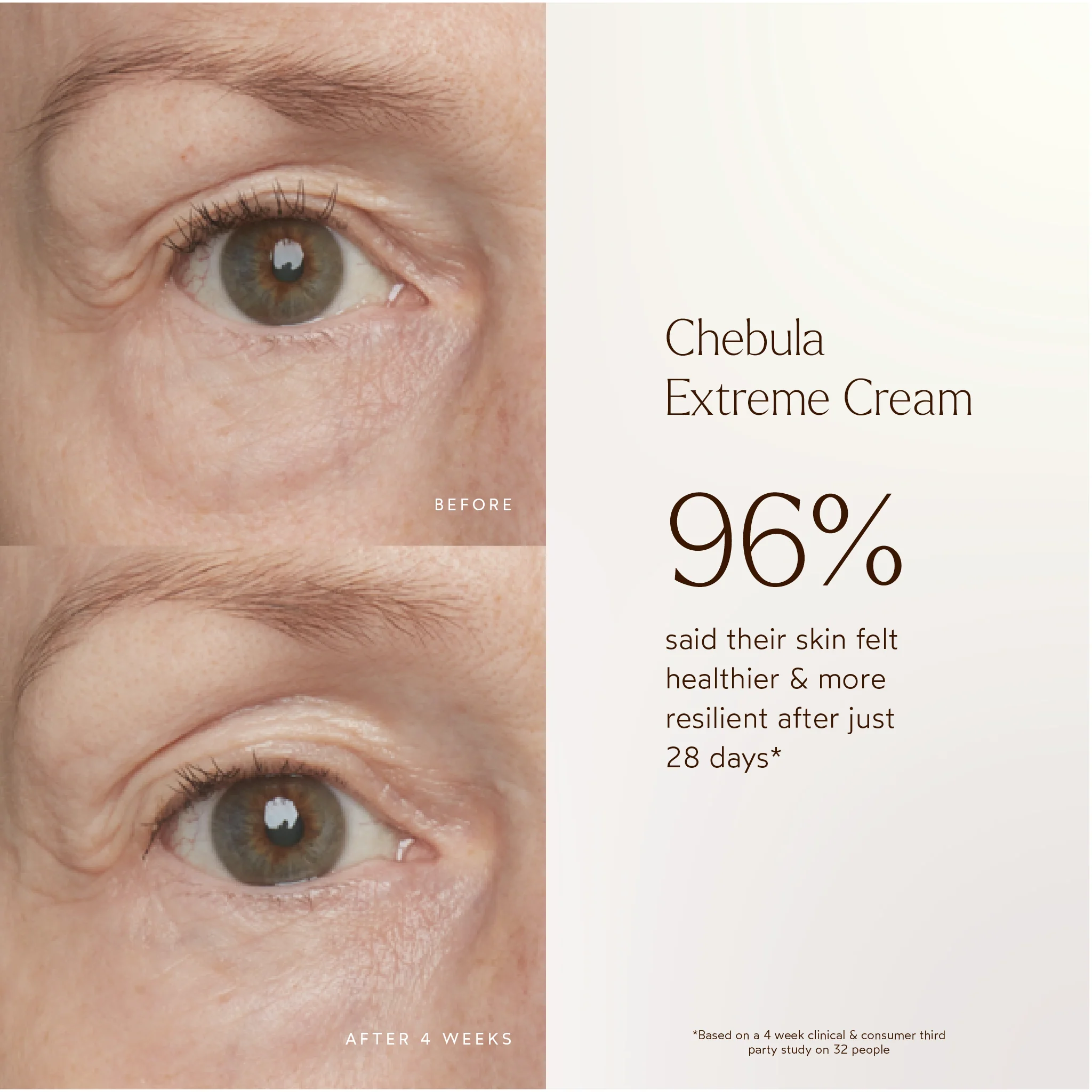 Renew Chebula Extreme Cream 5 Renew Chebula Extreme Cream