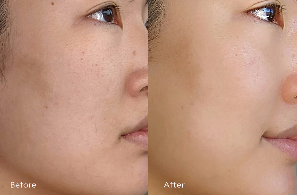 Resurfacing Serum 7 Resurfacing Serum