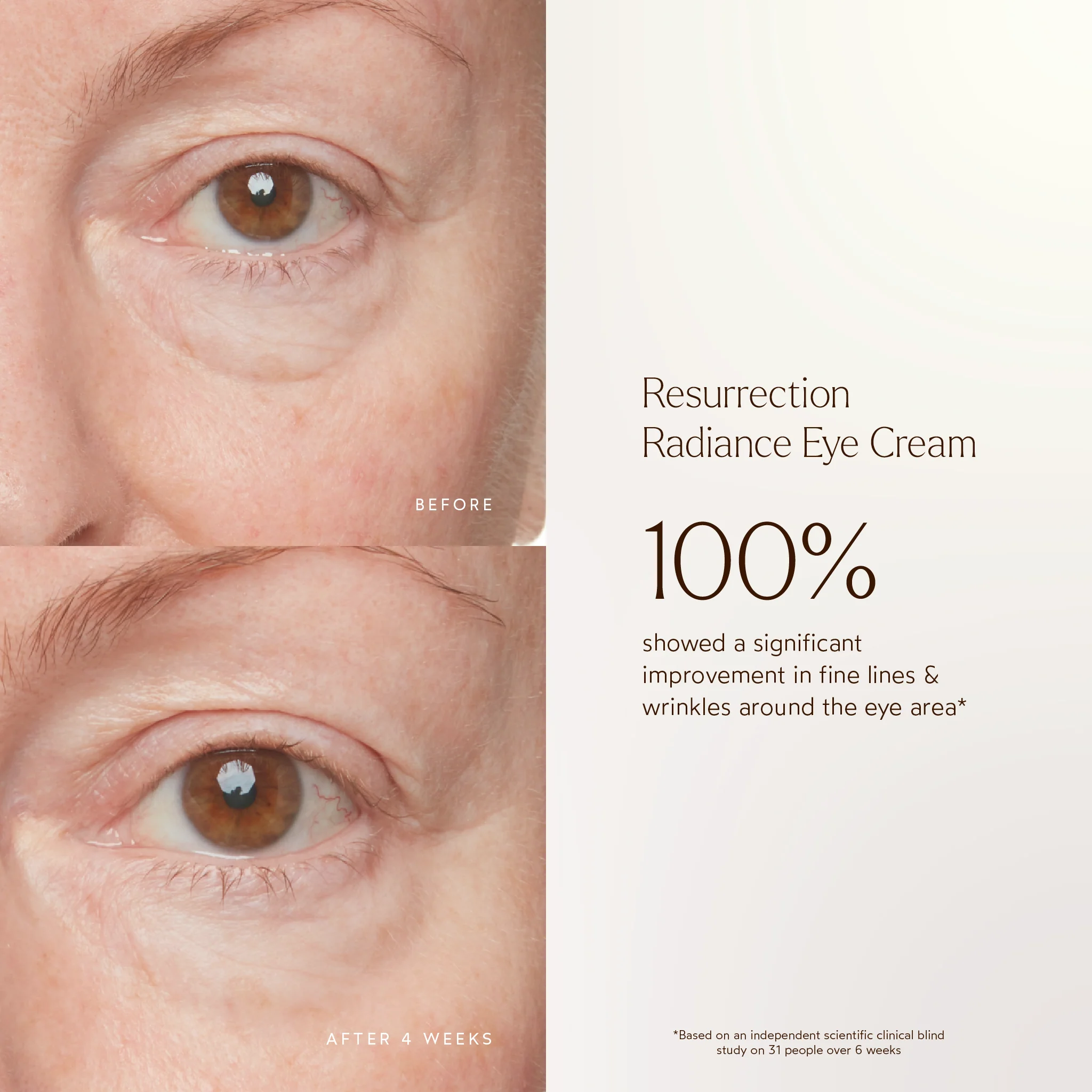 Resurrection Radiance Anti-Aging Eye Cream 3 Resurrection Radiance Anti-Aging Eye Cream