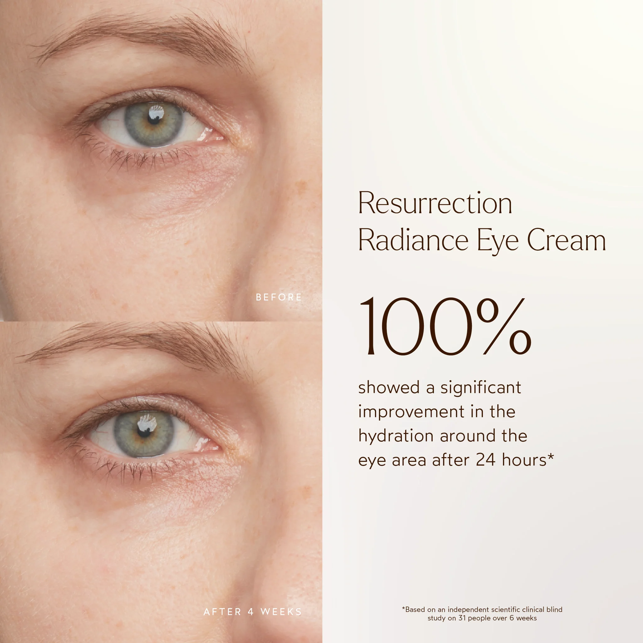 Resurrection Radiance Anti-Aging Eye Cream 4 Resurrection Radiance Anti-Aging Eye Cream