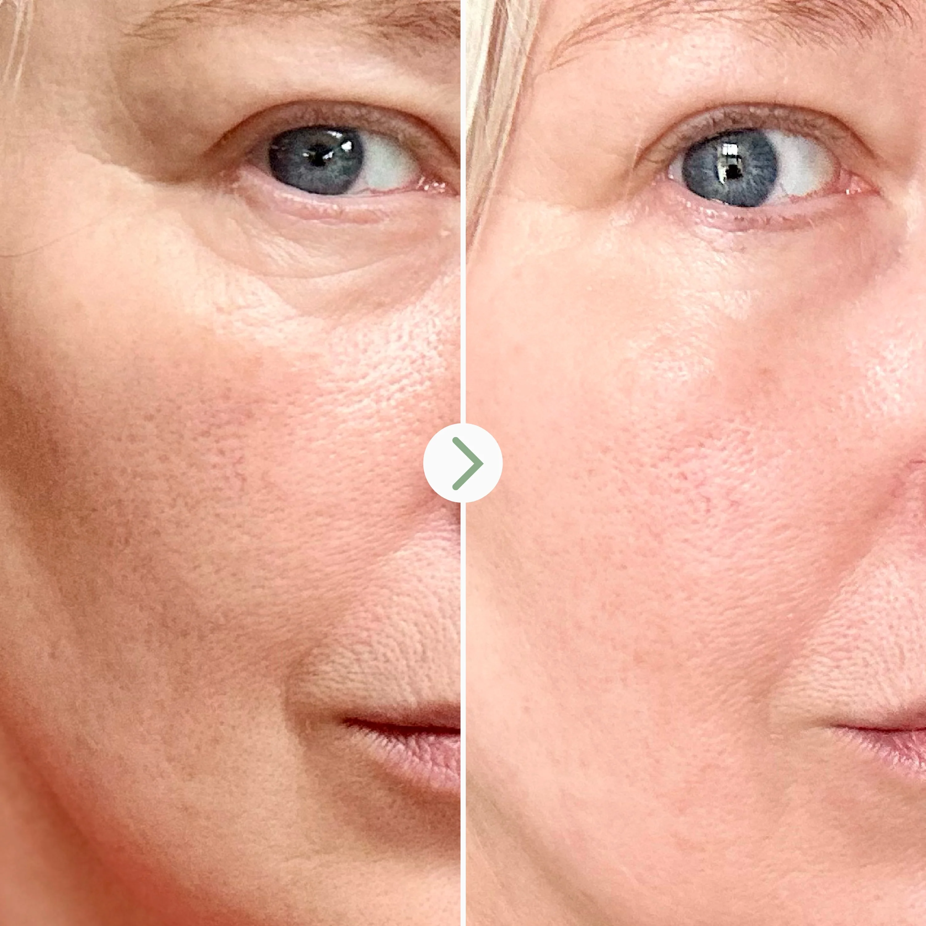 Retinal 0.16% Skin Renewal Booster 4 Retinal 0.16% Skin Renewal Booster